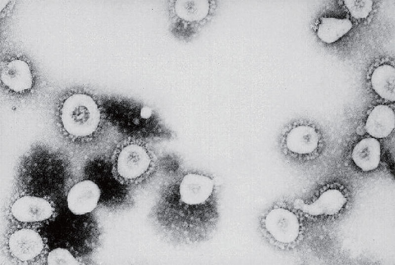 最新南極細菌研究 無法解釋病毒從何而來