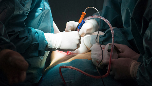 香港中國擬器官移植共享 專家：國際將抵制