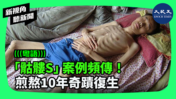 「骷髏S」案例頻傳！煎熬10年奇蹟復生