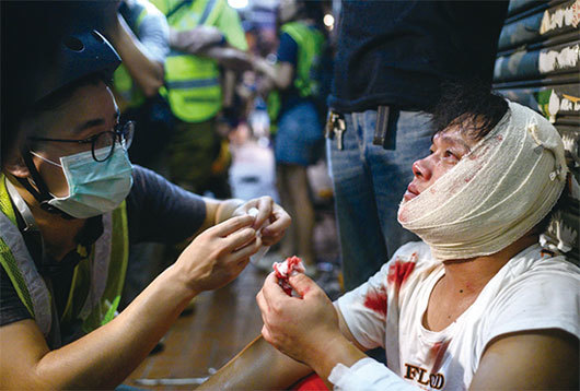香港醫管局表示，截至8月5日晚11時，有24人受傷求醫。圖為在荃灣的一位受傷者。（Getty Images）