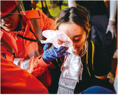 中共央視引用五毛的造謠，誣衊香港被打爆眼球的少女，並指她是「被自己人打傷」。（AFP）