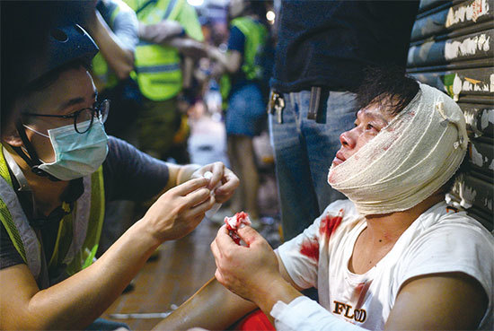 反送中核實信息頻道確認8月7日荃灣眾安街被大批白衣人追斬的年輕抗議者當日被斬斷手腳筋。圖為一名在荃灣抗議的傷者。（AFP）