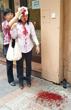 9月24日下午約四點左右，法輪功學員廖秋蘭在長沙灣警署附近被襲擊，頭部受傷。（大紀元）