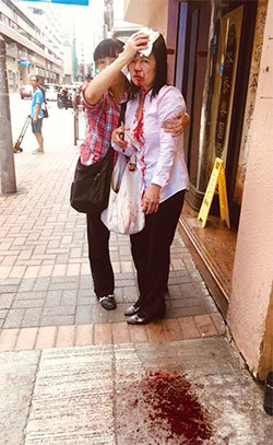 9月24日，香港一天發生三起襲擊事件，其中法輪功學員廖秋蘭在長沙灣警署附近被襲擊，頭破血流。（黃曉翔／大紀元）