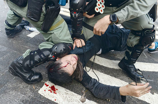 香港特首林鄭月娥11月與習近平及韓正會面後，港警就在12天內抓捕近1500人。圖為香港中大學生11月12日被打爆頭流血。（宋碧龍／大紀元）