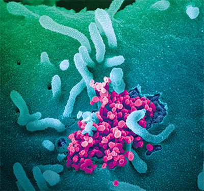 中共肺炎疫情爆發後，國際聚焦武漢新冠病毒疑來自武漢P4實驗室，為加工病毒，是中共研發的最致命生化武器。圖為引起Covid-19的SARS-CoV-2顯微圖。（AFP）