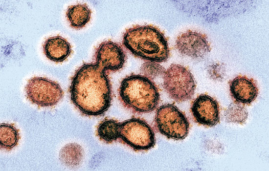 中共提出一系列藉口，加劇人們對SARS-CoV-2起源的懷疑。證據表明，SARS-CoV-2是在武漢病毒研究所進行研究。圖為SARS-CoV-2顯微圖。（AFP）