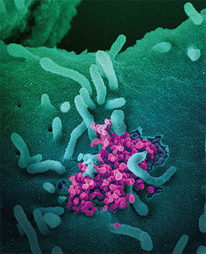 專家研究了中共病毒的特徵和結構，認定中共病毒不可能是人工製造。圖為SARS-CoV-2（圓形洋紅色物體）顯微圖。（AFP）