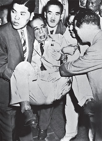 1960年7月14日，安倍外祖父、日本首相岸信介被右翼狂熱分子刺中左腿。（AFP）