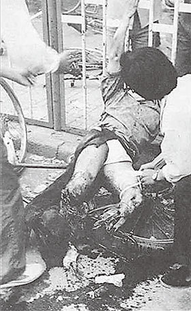 1989年6月4日淩晨，中共坦克悍然開進北京鎮壓愛國學生，方政當時為救一位女同學，在西長安街被共軍坦克碾斷雙腿時的慘況。（圖片來源：六四檔案）